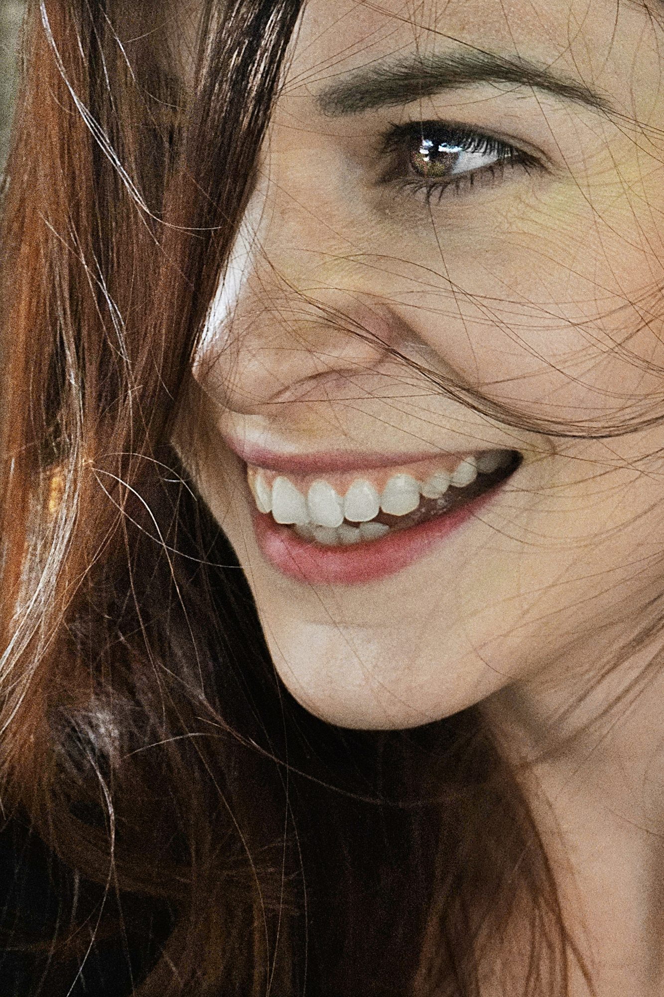 Blanqueamiento dental